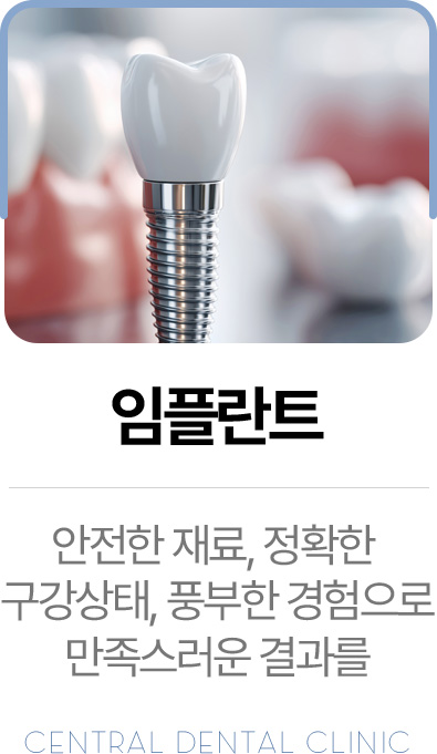 센트럴치과 임플란트, 안전한 재료와 정확한 구강 상태 진단