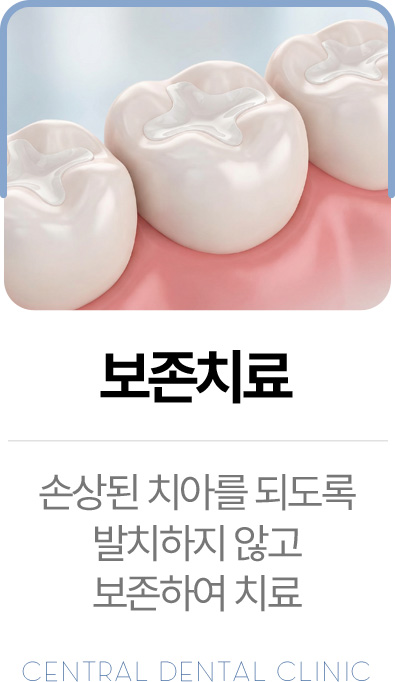 센트럴치과 보존치료, 손상된 치아를 발치하지 않고 보존하는 치료