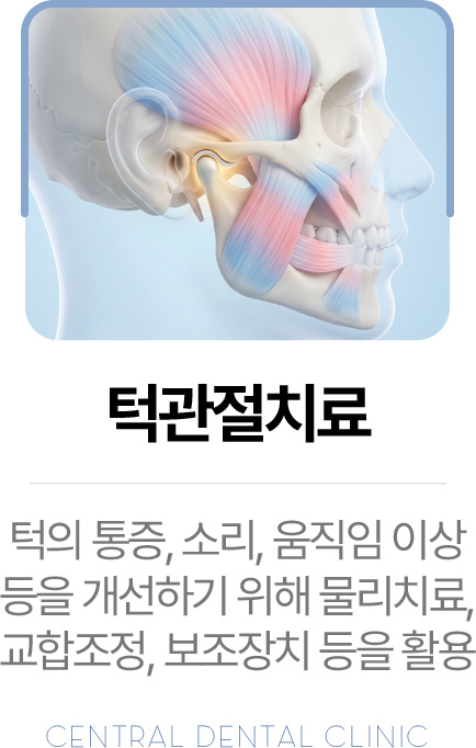 센트럴치과 턱관절치료, 물리치료·교합조정·보조장치를 활용한 치료