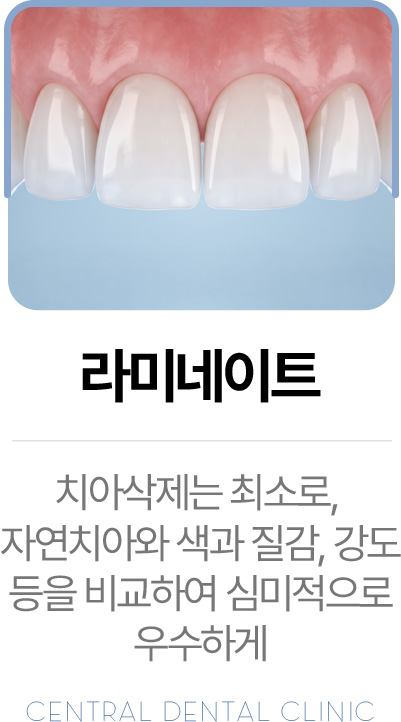 센트럴치과 라미네이트, 최소 삭제를 고려한 심미치료