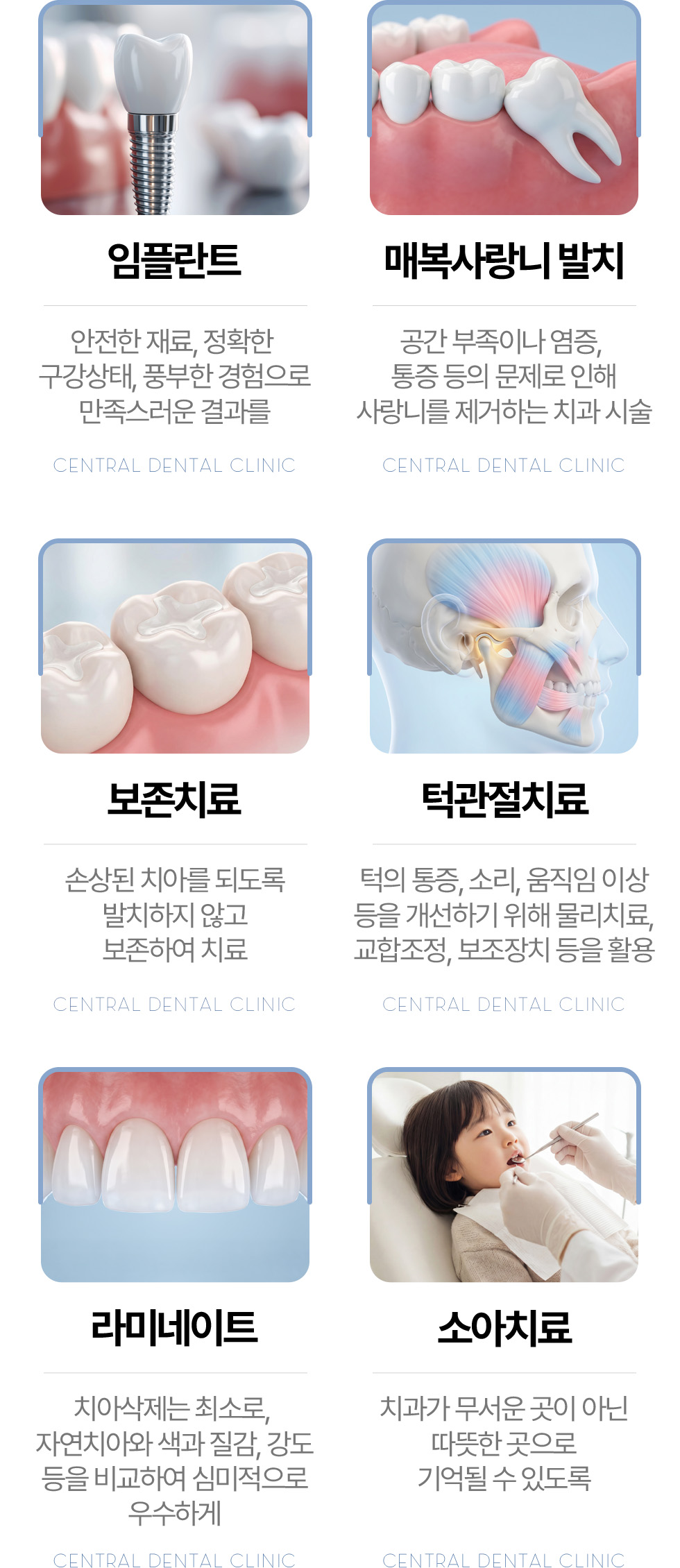 센트럴치과 임플란트, 매복사랑니 발치, 보존치료, 턱관절치료, 라미네이트, 소아치료
