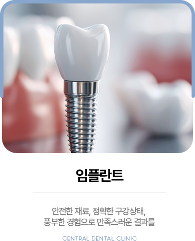 센트럴치과 임플란트, 안전한 재료와 정확한 구강 상태 진단
