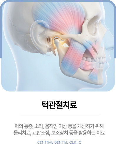 센트럴치과 턱관절치료, 물리치료·교합조정·보조장치를 활용한 치료