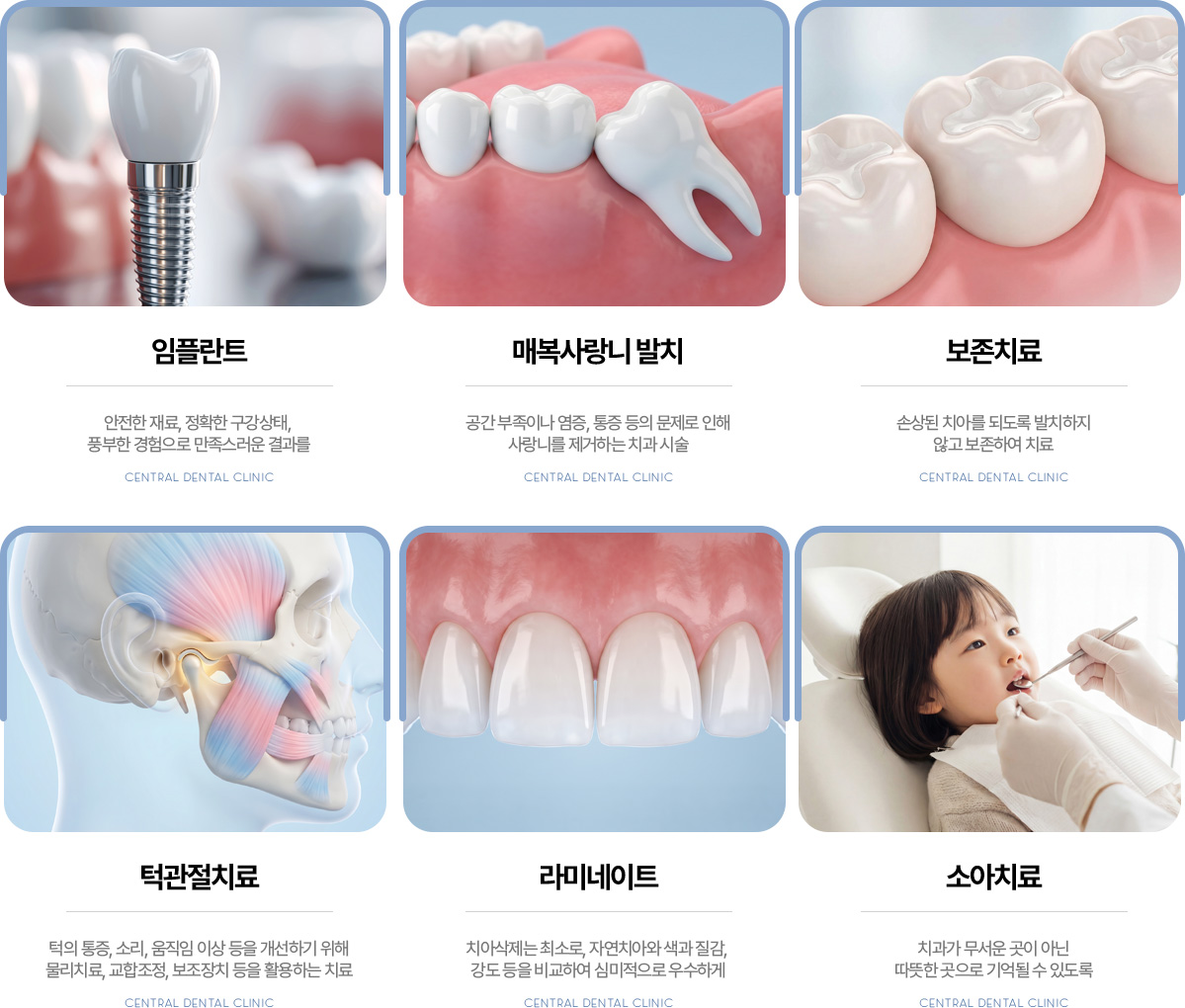센트럴치과 임플란트, 매복사랑니 발치, 보존치료, 턱관절치료, 라미네이트, 소아치료
